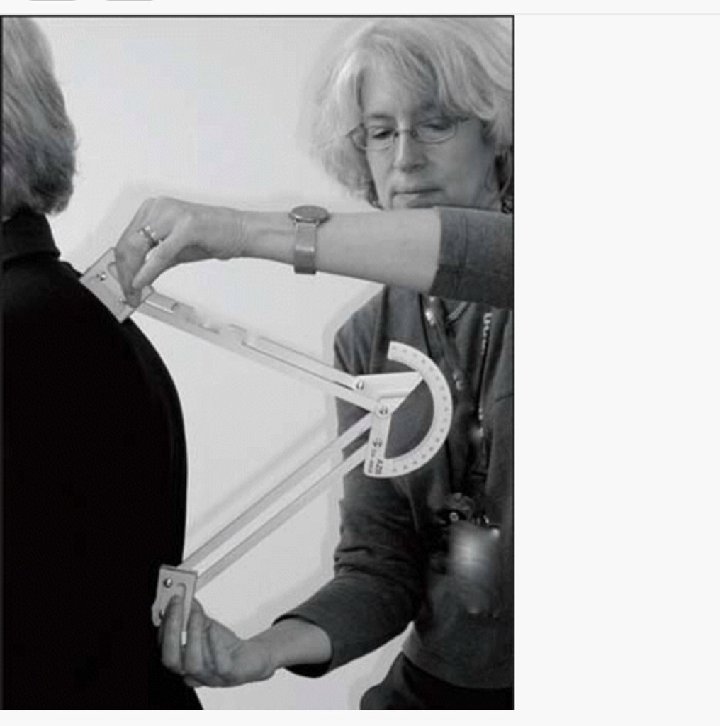 Backhunch How to Get Rid of the Hunch in Your Back | Posture Movement Pain