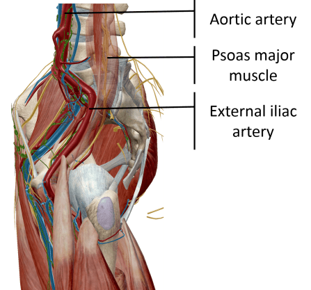 external iliac artery side view