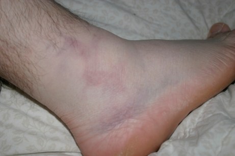 96274193_ba07549c15_o