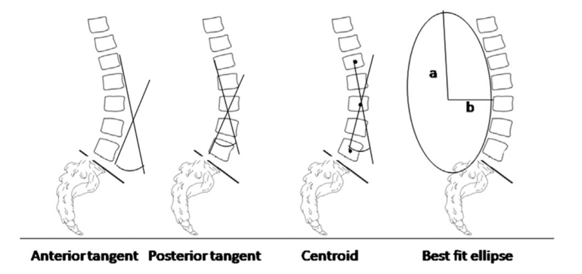 If I have too much curve in my back will it cause back pain? | Posture ...